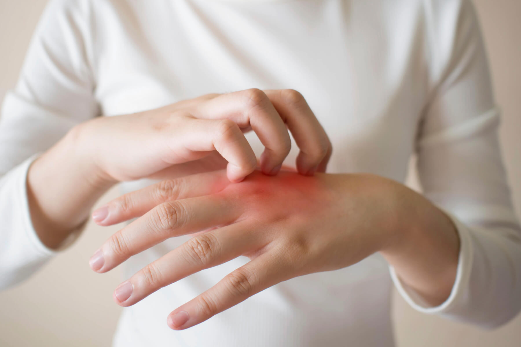 uczulenie na wełnę